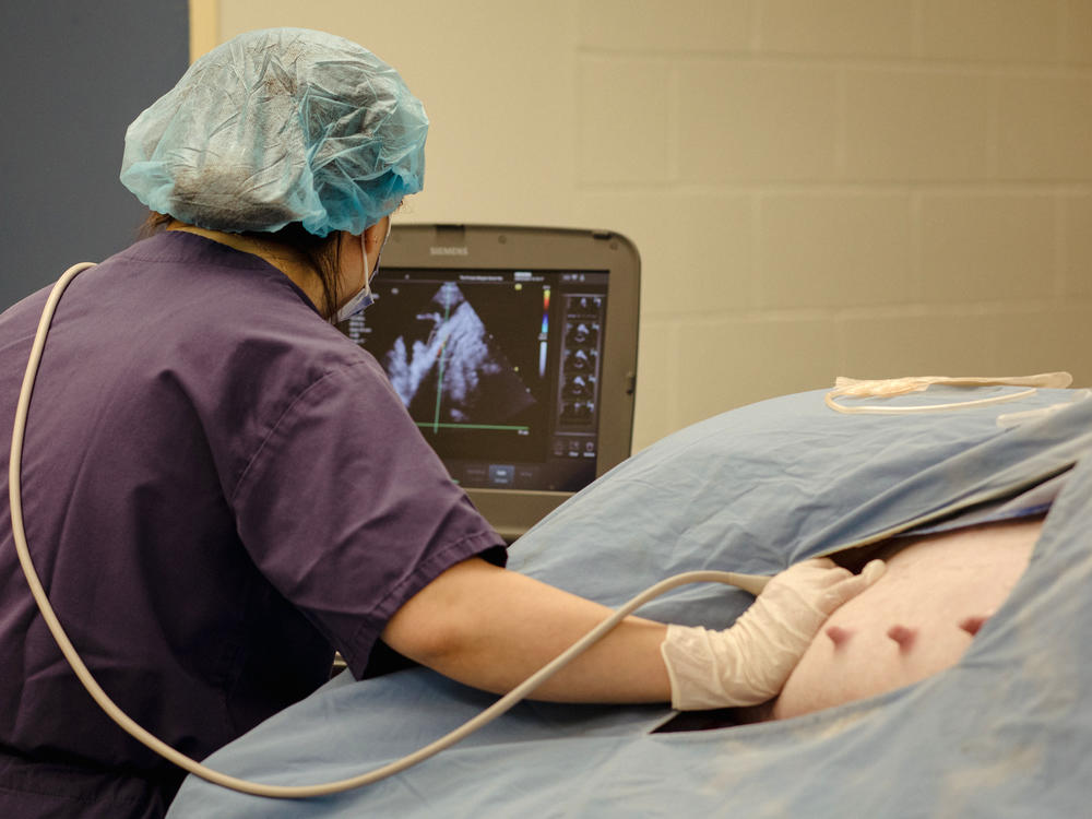 A technician scans the belly of a pregnant pig before an operation to transfer a fetus to an artificial womb.