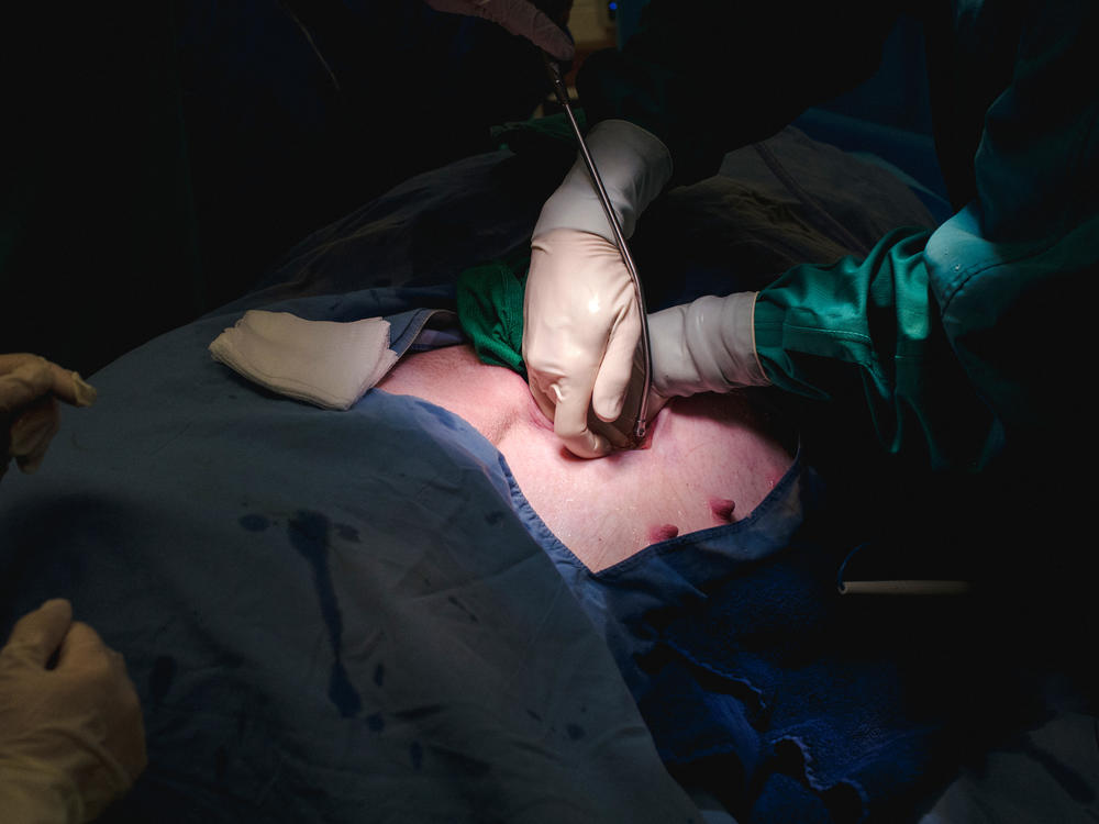 Dr. Christoph Haller performs surgery to remove a fetal pig from the adult pig's womb.