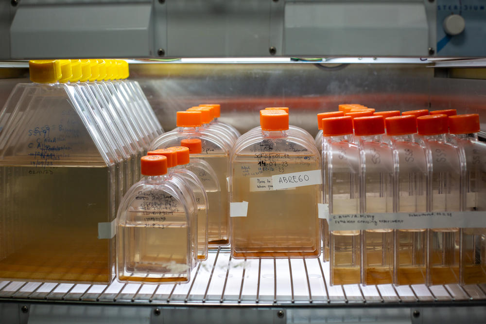Algae in Nitschke's lab, grown over hundreds of generations. They've been exposed to heat, singling out those best able to handle higher temperatures, which then go to produce more heat-tolerant algae.