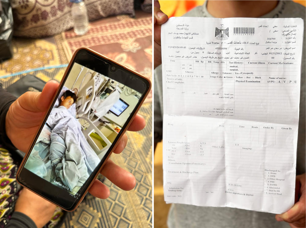Nimer's grandmother Salwa Yusuf Mahmoud Mashaa shows NPR a photo of Nimer at the Soroka hospital in Be'er Sheva, Israel. Medical records reviewed by NPR show that Nimer is suffering from a fractured femur and vertebrae, loss of motor function in his foot and swelling along his sciatic nerve. Records indicate there is still shrapnel left inside Nimer's abdomen and backside.