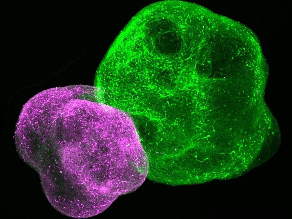 This image shows a brain 