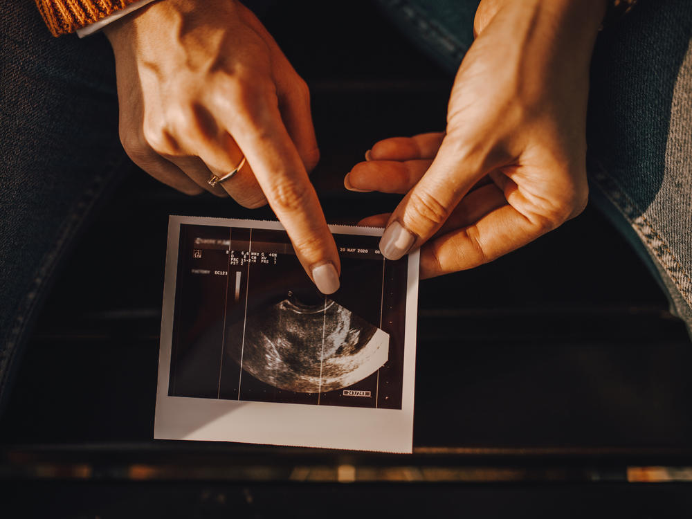 The medical community dates pregnancy to the first day of a woman's last period, even though fertilization generally happens two weeks after that. It's a long-standing practice but a confusing one.