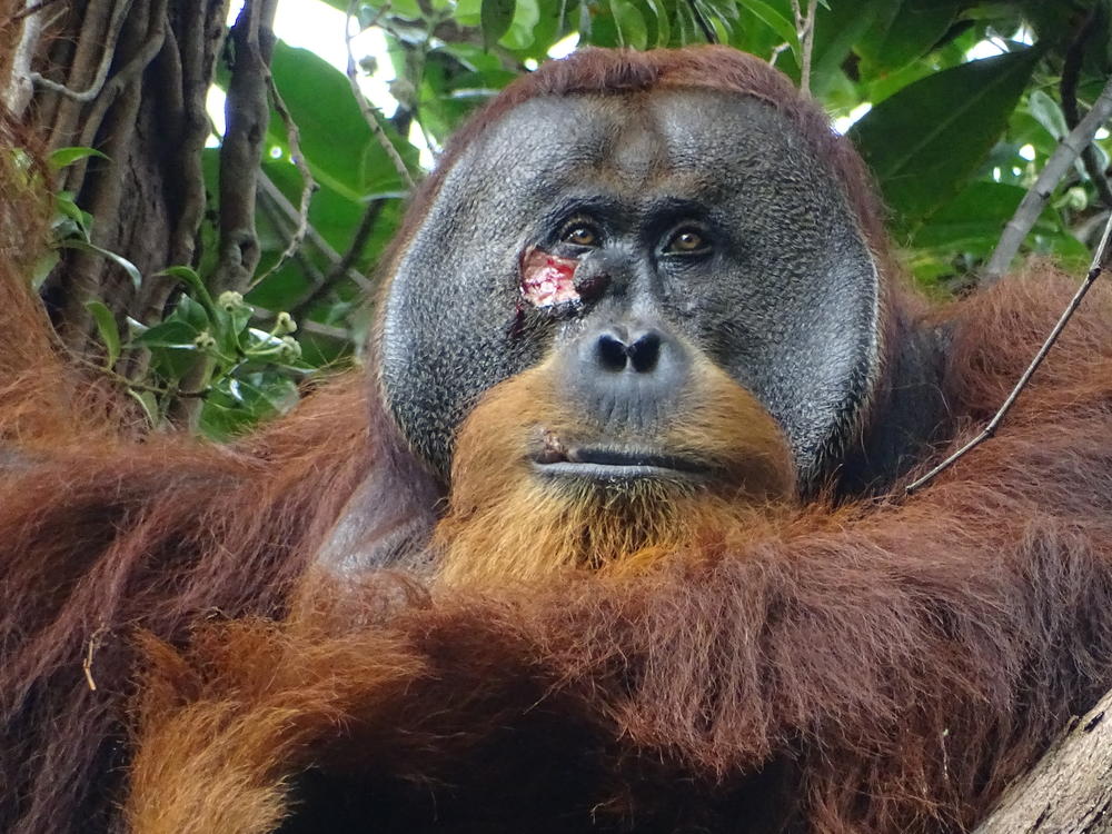 Researchers in a rainforest in Indonesia spotted an injury on the face of a male orangutan they named Rakus. They were stunned to watch him treat his wound with a medicinal plant.