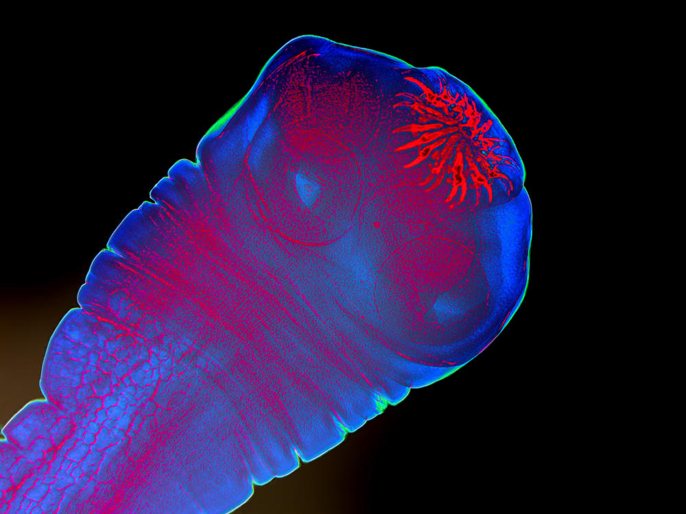 A magnification of the anterior of the larva of the pork tapeworm, showing hooks and suckers. Colors of this image have been manipulated. Parasitic worms made the news after the press reported on a past deposition by Robert F. Kennedy Jr. that he had been infected by a parasitic worm. RFK Jr. did not specify the type of worm but worm researchers believe it could have been a pork tapeworm.