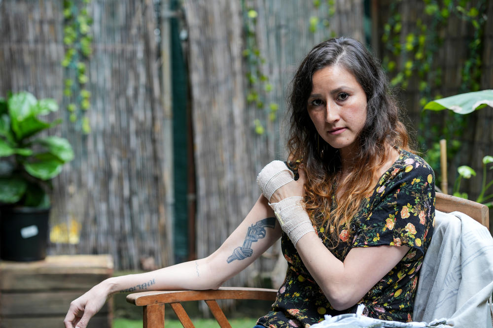 Allie Wong's tattoo is of a sculpture titled 