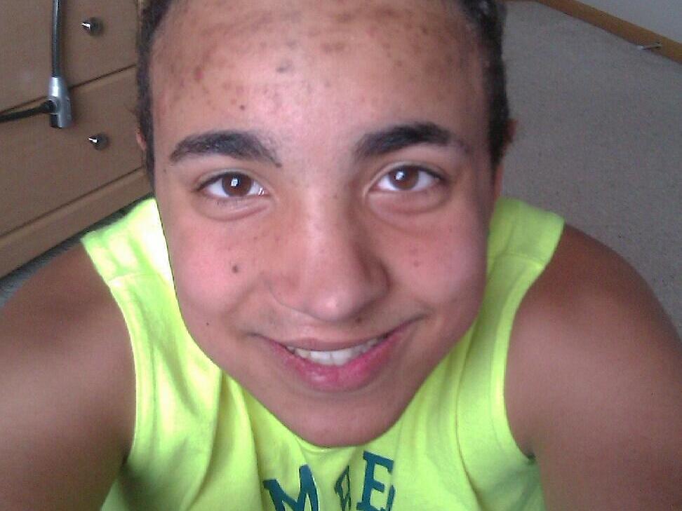 Alexander “AJ” Betts Jr. was 16 when he died by suicide in 2013 in Des Moines, Iowa. His internal organs were transplanted, but his eyes went untouched because of an FDA rule that essentially bans sexually active gay men and boys from donating tissue.