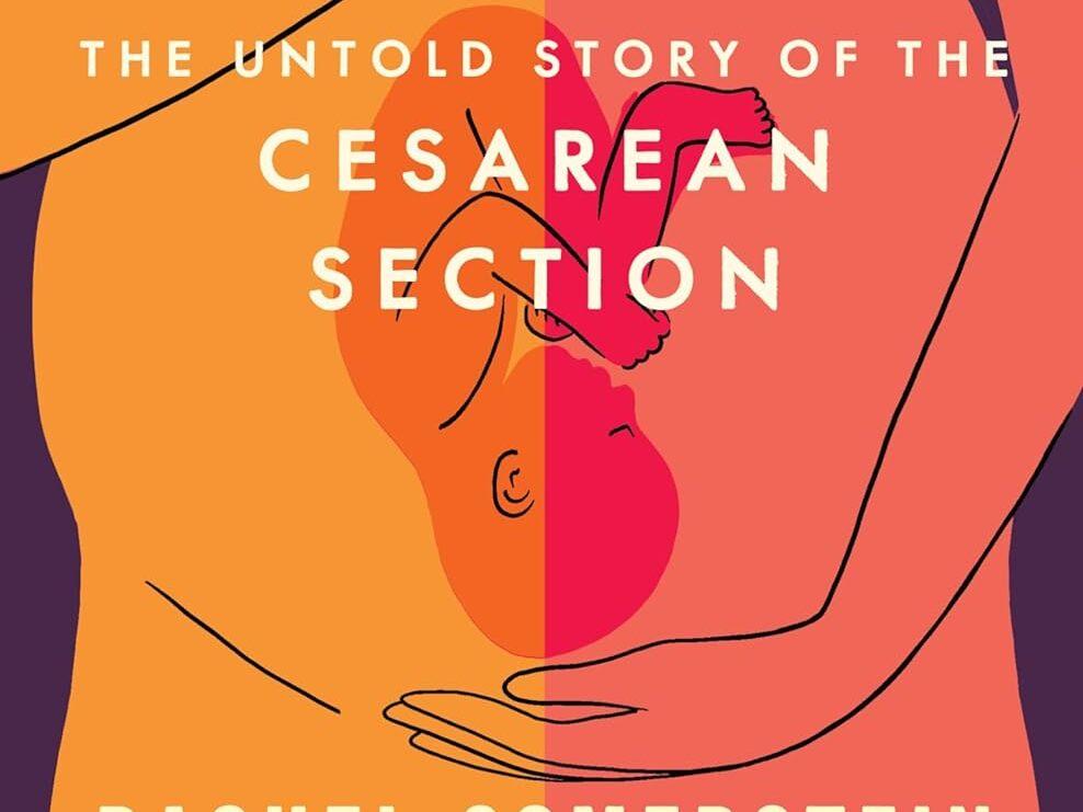 <em> Invisible Labor: The Untold Story of the Cesarean Section, </em>by Rachel Somerstein