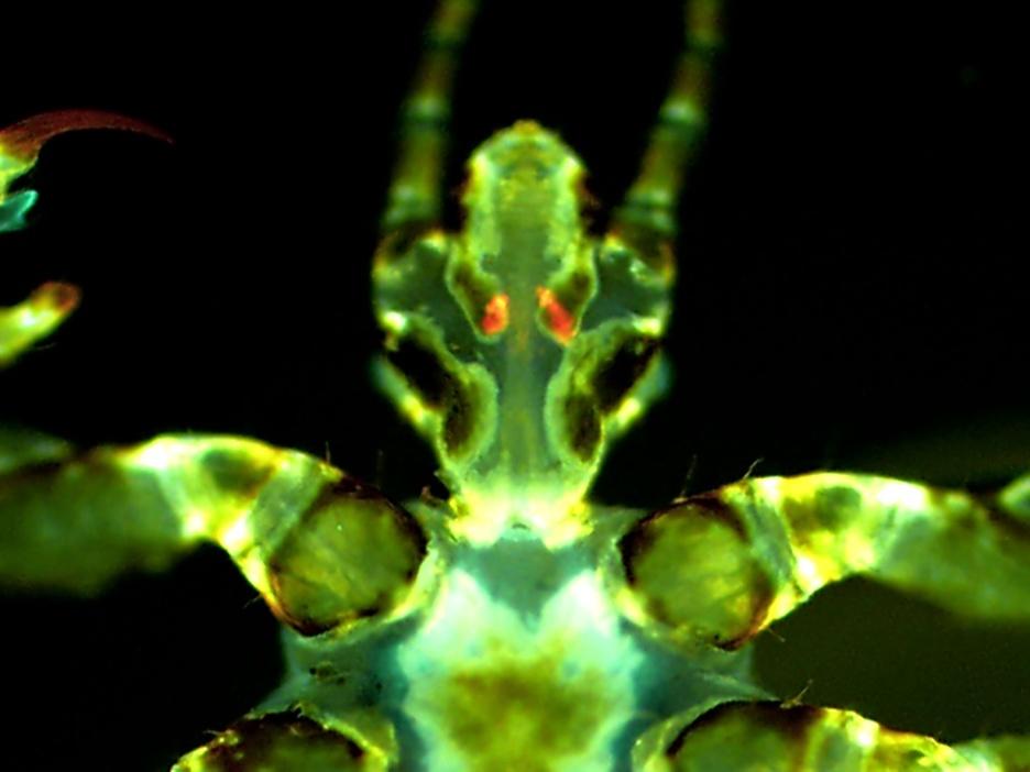 A fluorescent image of a human body louse with <em>Yersinia pestis</em> infection — that's the cause of the plague — depicted in orange/red in the glands.<br>