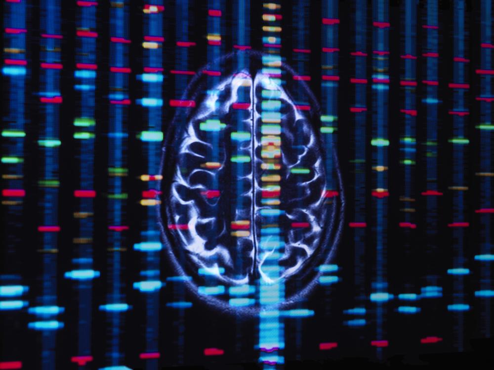 A new study looks at the roles that African and European genetic ancestries can play in Black Americans' risk for some brain disorders. 
