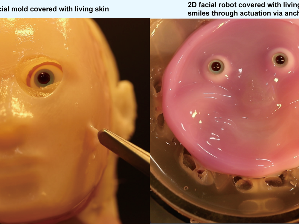 A new method of binding living skin tissue to a robotic skeleton will allow more humanlike expressions and better range of motion, according to researchers from the University of Tokyo.