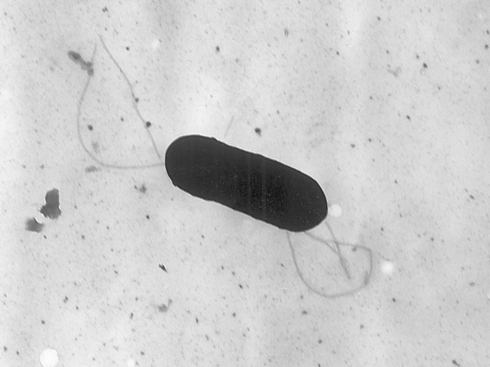 An electron microscope image of a Listeria monocytogenes bacterium, which has been linked to an outbreak spread through deli meat. Boar's Head recalled meat on Friday, after two deaths and 33 hospitalizations linked to Listeria.