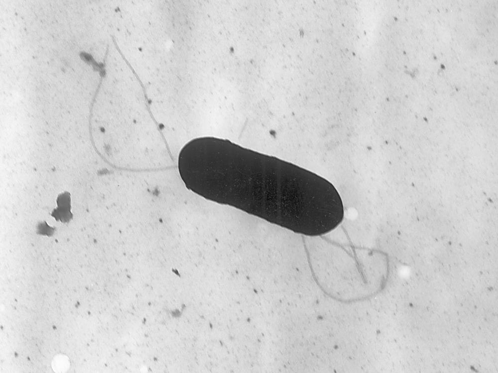This 2002 electron microscope image from the Centers for Disease Control and Prevention shows a Listeria monocytogenes bacterium. Health officials have announced a recall of liverwurst and deli meat products in connection with a national listeria outbreak that has sickened nearly three dozen people in 13 states. 