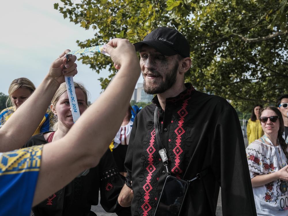 Andriy Smolensky, an injured Ukrainian soldier, receives a medal.