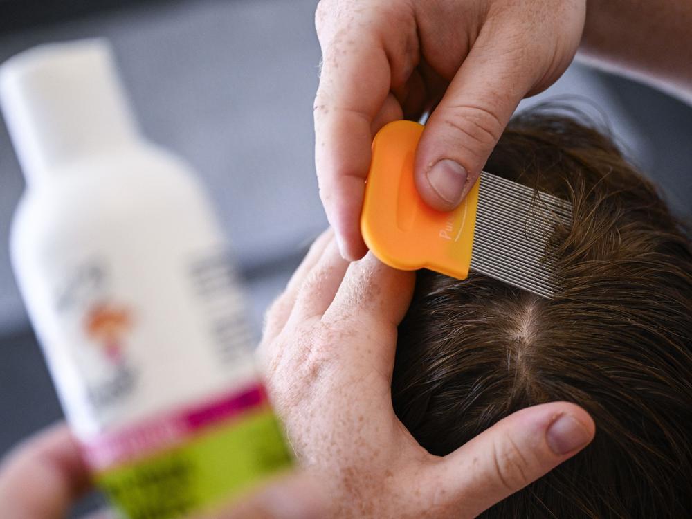 A child receives care against head lice.