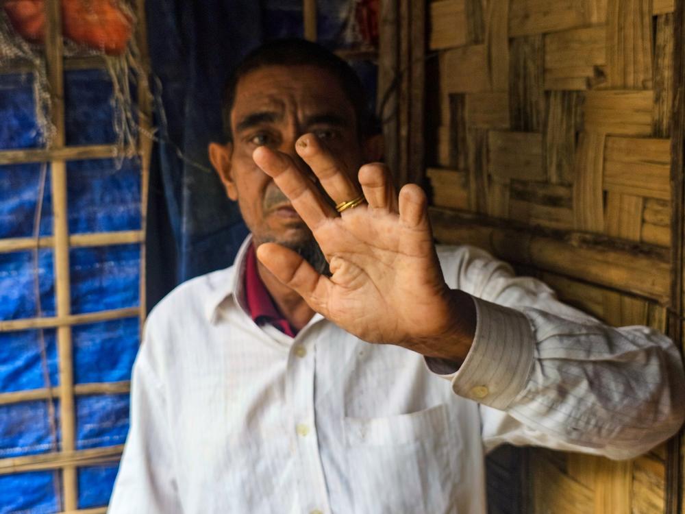Badi Alom, age 62, says his fingers were cut after he was detained by the rebel Arakan Army when he went to a bazaar to buy fish for his family. He and his family now live in the Rohingya refugee settlement in Bangladesh.<br>