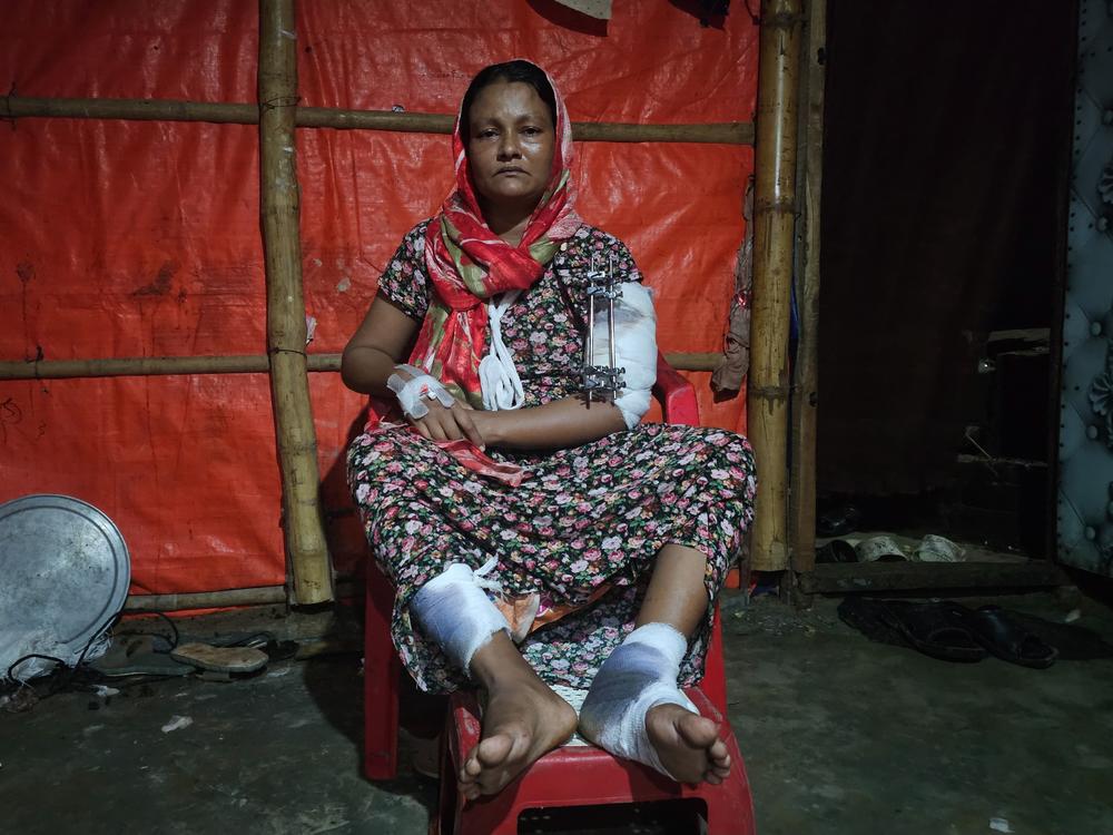 Humaira, age 34, is the mother of five children. She was injured in a drone attack by the Arakan Army on August 4, as Rohingya citizens have been caught up in ongoing conflict between the rebel troop and government forces in their state. The family fled to Bangladesh, where Humaira and other injured family members have been treated by staff from Doctors without Borders. 