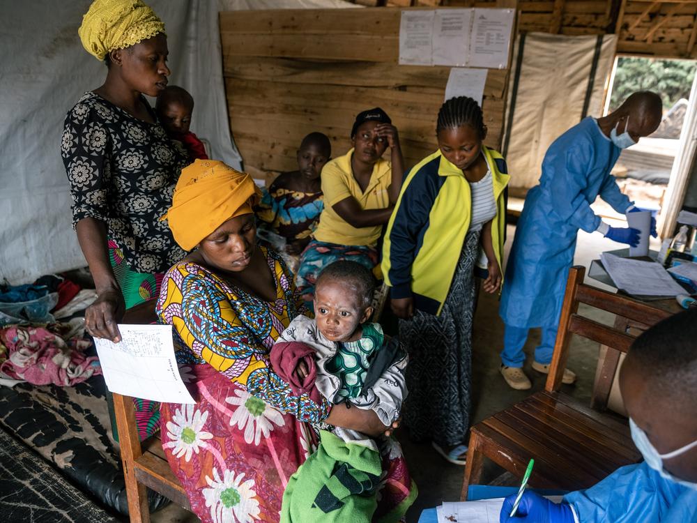 A doctor discusses treatment for mpox with the mother of an infected infant at the Kavumu hospital in the Democratic Republic of Congo. For 18 months, the Congolese have struggled to control an epidemic of the disease without the benefit of vaccines.  The majority of cases and deaths have been in children.  