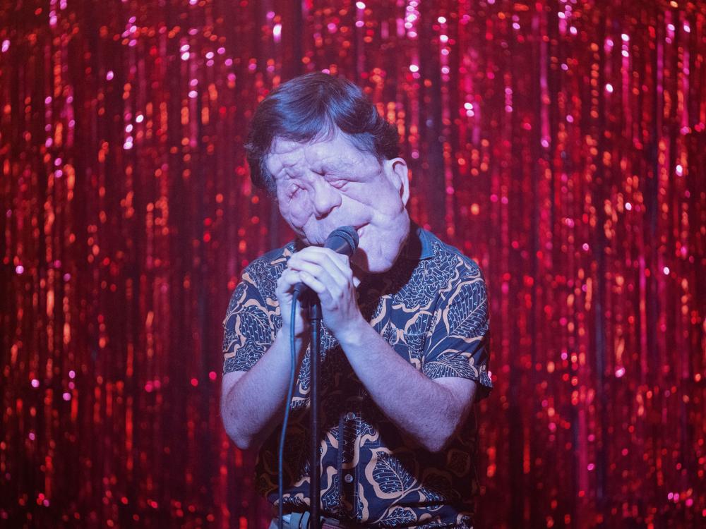  British actor Adam Pearson plays Oswald in <em>A Different Man.</em>