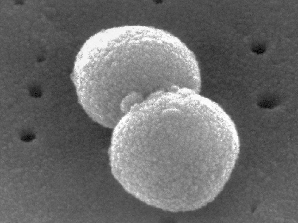 This electron microscopic image provided by the Centers for Disease Control and Prevention shows two, round-shaped, Gram-positive, Streptococcus pneumoniae bacteria.
