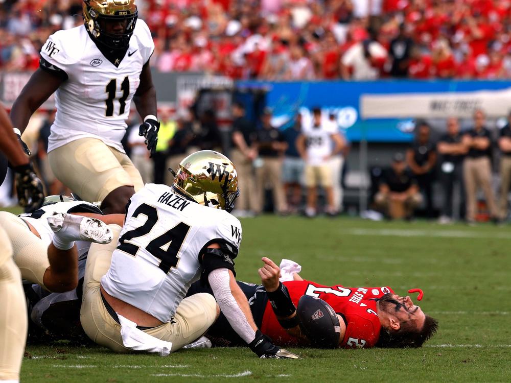 Grayson McCall of the NC State Wolfpack falls to the ground after a hit by Dylan Hazen of the Wake Forest Demon Deacons on October 5, 2024 in Raleigh, N.C. It was this hit, where his helmet flew off, that he suffered a concussion and led to his retirement from the sport.