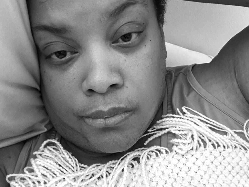 Dawn shared this selfie in a 2023 Facebook post about her experience as a long-term caregiver. She captioned it: 