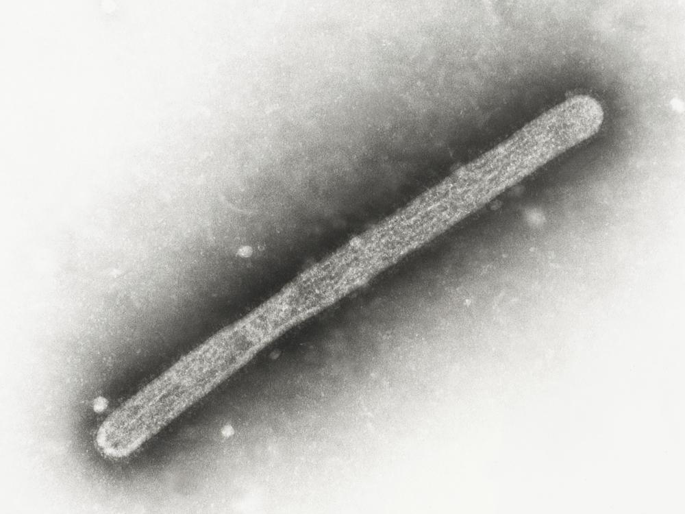 A 2005 electron microscope image shows an avian influenza A H5N1 virion. A pig at an Oregon farm was found to have bird flu, the U.S. Department of Agriculture said Wednesday.