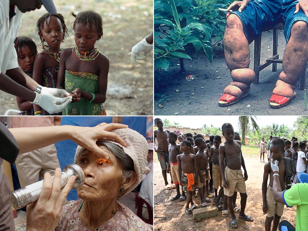 Clockwise from upper left: Nomads from the Peul tribe give blood samples to be tested for sleeping sickness. In 2024, Chad got rid of one form of the disease. Brazil and Timor Leste eliminated lymphatic filariasis, the disfiguring parasite that causes a condition known as elephantiasis. A doctor sees children during a leprosy screening campaign; Jordan eliminated the disease this year. An elderly farmer woman receives an eye exam for trachoma in Vietnam — which along with India and Pakistan — eradicated th…