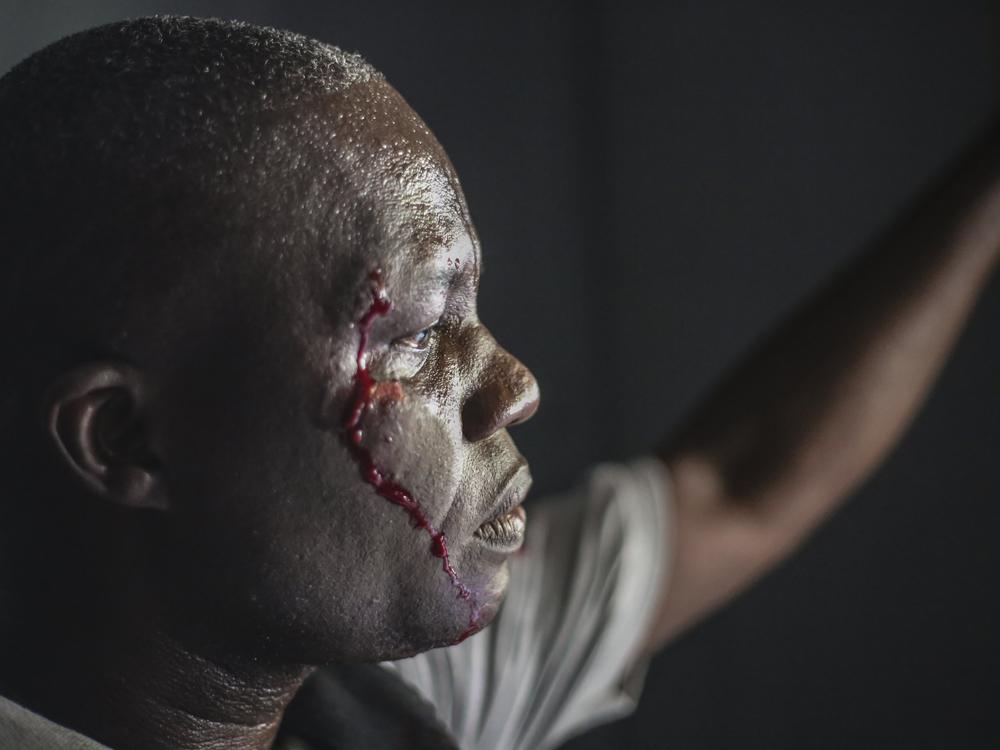 A wounded security officer looks on after being shot by armed gangs at the General Hospital in Port-au-Prince, Haiti, Tuesday, Dec. 24, 2024.