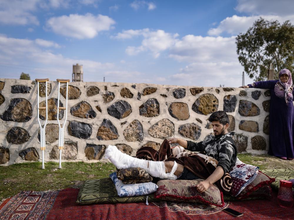 A young man who was shot by the Israeli military during a protest against the Israeli presence rests his leg outside his home on Jan. 2 in Golan Heights, Syria. Since the fall of Bashar al-Assad, the Israel military has taken new positions in Golan Heights areas.