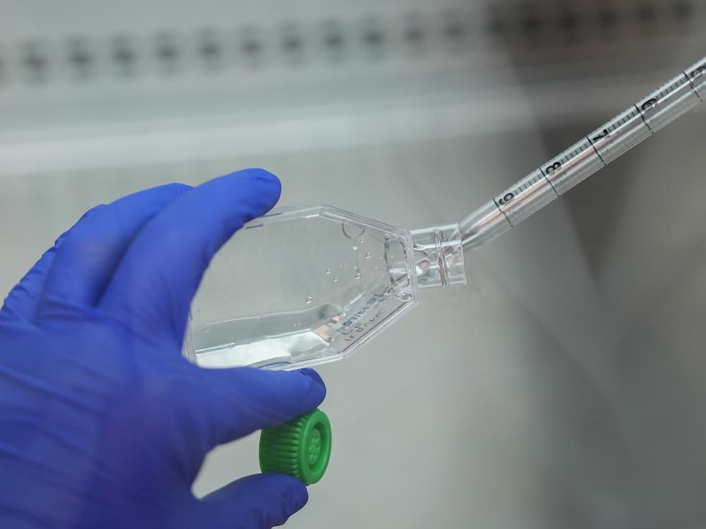 Lung tissue samples that will be used in research are prepared at the University of Toledo in Toledo, Ohio on Sept. 5, 2024.