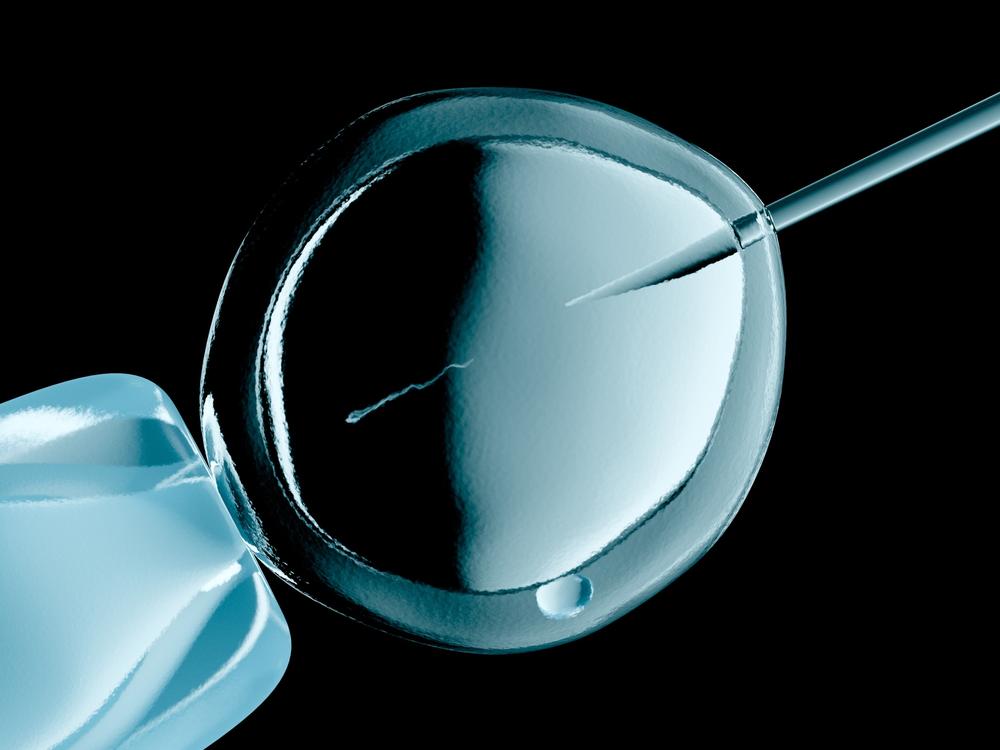 IVF is a process that involves retrieving eggs from ovaries, fertilizing them with sperm in a lab, and then transferring embryos into the uterus.