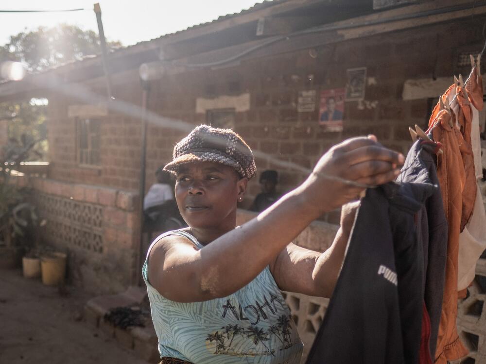 Mable Besa, 49, hangs up laundry on her washing line in the lead-contaminated neighborhood of Magandanyama in Kabwe, Zambia. Nearly a century of lead mining and smelting in the town has left Magandanyama's dust with extreme levels of lead. Beta lives with two of her grandchildren, both of whom suffer from lead poisoning. 