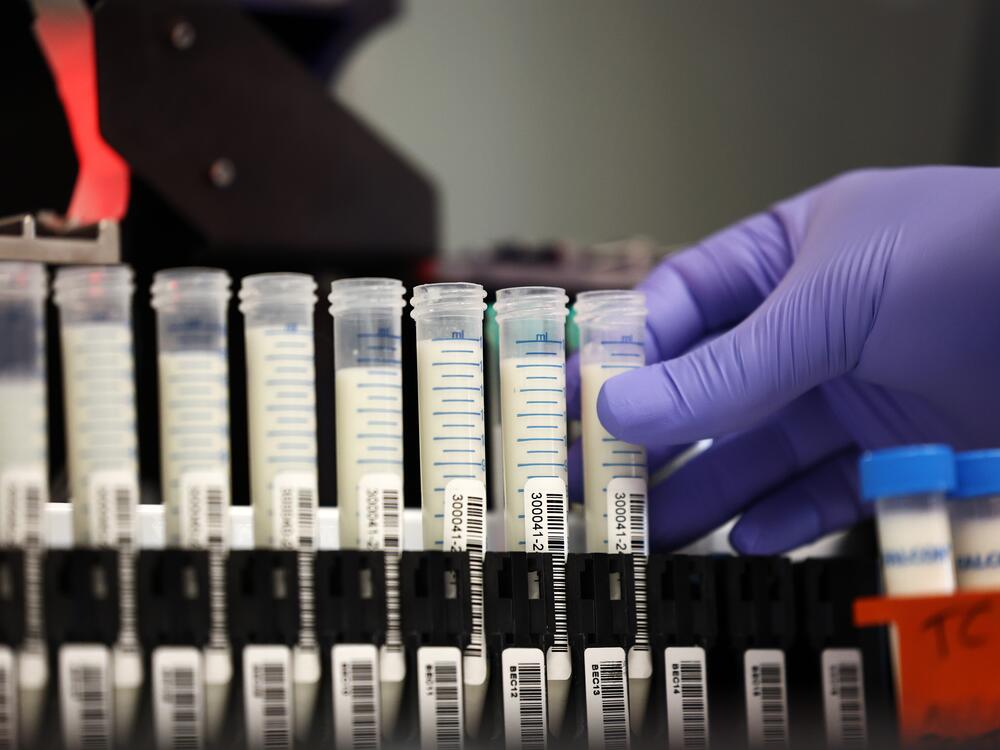 A lab manager in the molecular diagnostic lab prepares milk samples for testing at the Animal Health Diagnostic Center at Cornell University in Ithaca, N.Y., on Dec. 10, 2024, amid increased concern over a strain of the H5N1 avian flu.