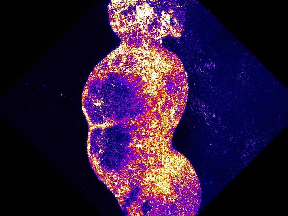 Researchers integrated four organoids that represent the four components of the human sensory pathway, along which pain signals are conveyed to the brain. Stimulation of the sensory organoid (top) by substances, such as capsaicin, triggers neuronal activity that is then transmitted throughout the rest of the organoids.