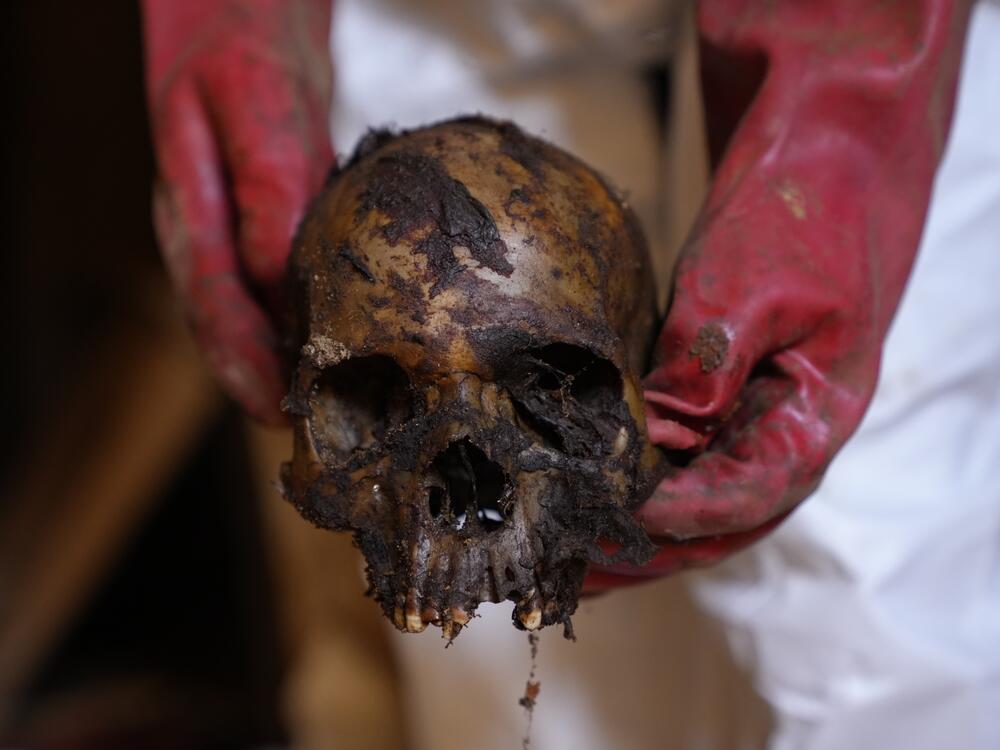 A skull found by the Rapid Support Forces' control of area in Omdurman in 2024.