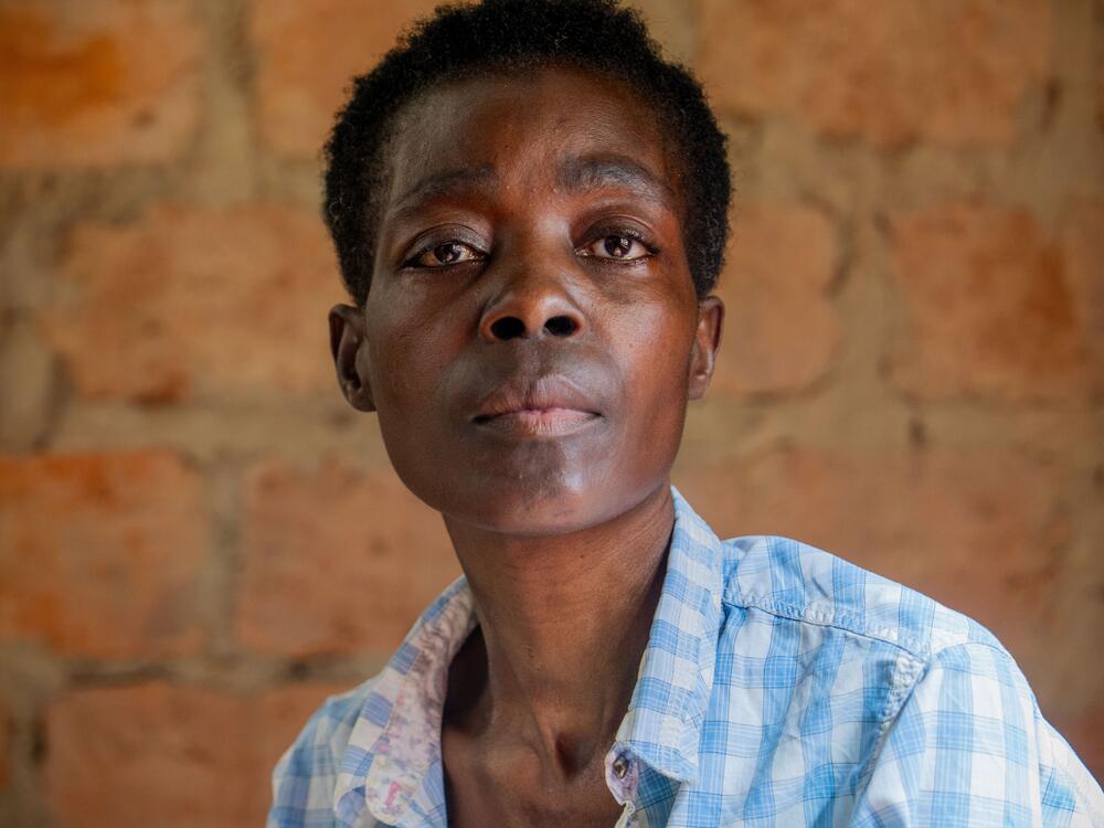 For more than two months, Mary hasn't been able to consistently take her HIV medication. She says she feels weak and has developed an itchy rash.