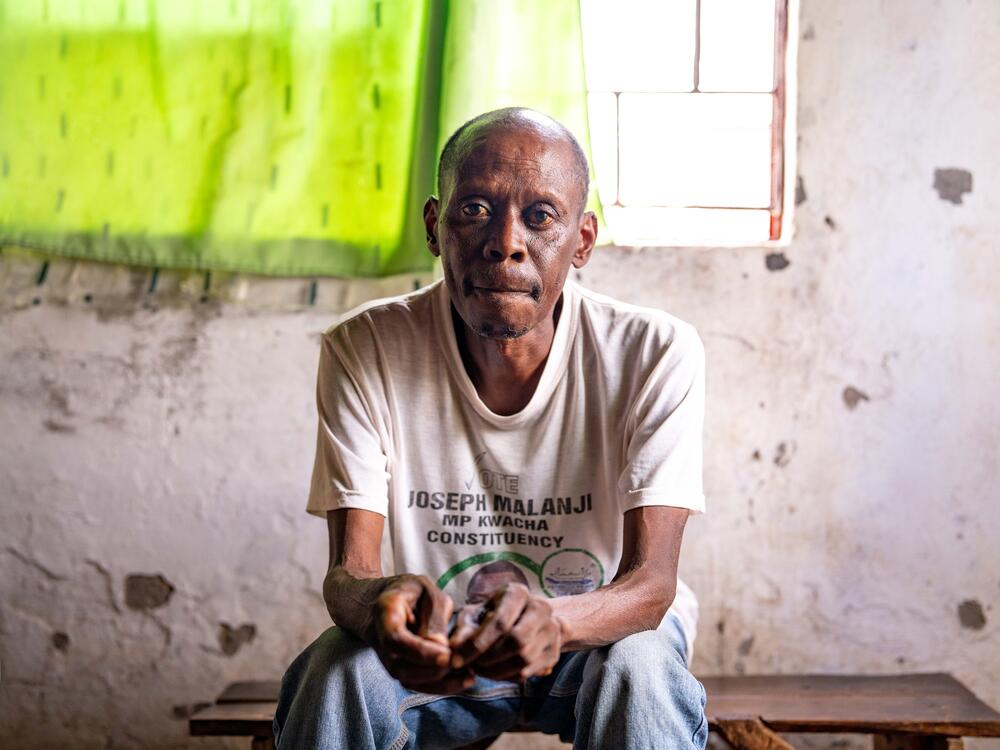 Brian Chiluba has lost weight and feels increasingly weak since losing access to his HIV drugs that he's received from a U.S.-funded clinic for the past 15 years.