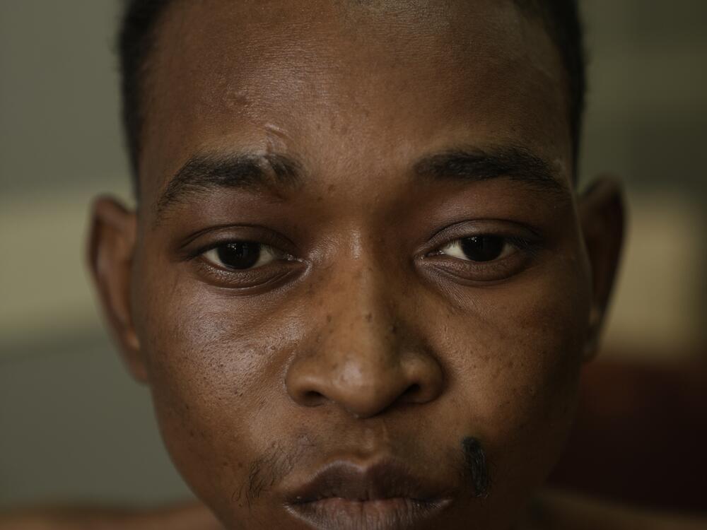 Munir Jelabi, 24, at a military hospital in Khartoum, where he is being treated for conditions caused by severe malnutrition. He was arrested by RSF and held in a detention center for over a year. 