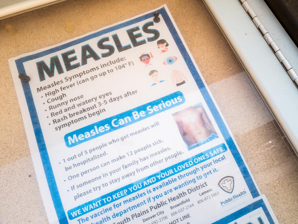A measles advisory is shown tacked to a bulletin board outside Gaines County Courthouse in Seminole, Texas, on April 9. The Texas Department of State Health Services has confirmed hundreds of measles cases.