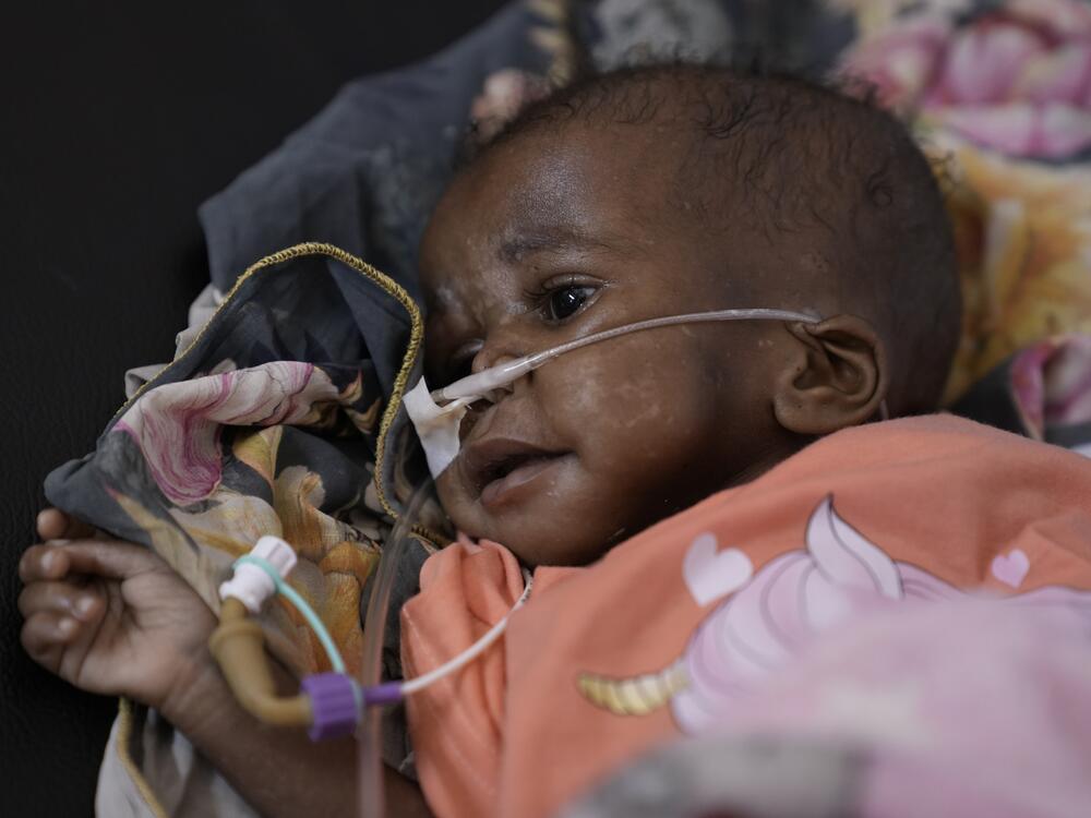 A baby being treated at the malnutrition ward in Al-Buluk Pediatric Hospital in Omdurman, Sudan.
