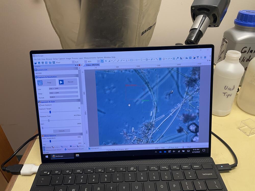 A zoo of microbes from a recent sampling trip swims into view on this computer screen, which is hooked up to a nearby microscope at Colorado State University.