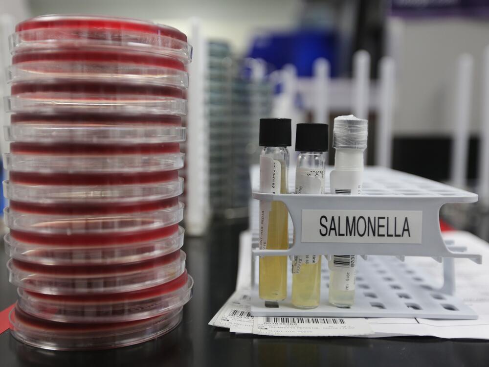 Agar plates with salmonella cultures ready for testing in the Medical Microbiology at the Houston Health and Human Services Department on June 18, 2015, in Houston.