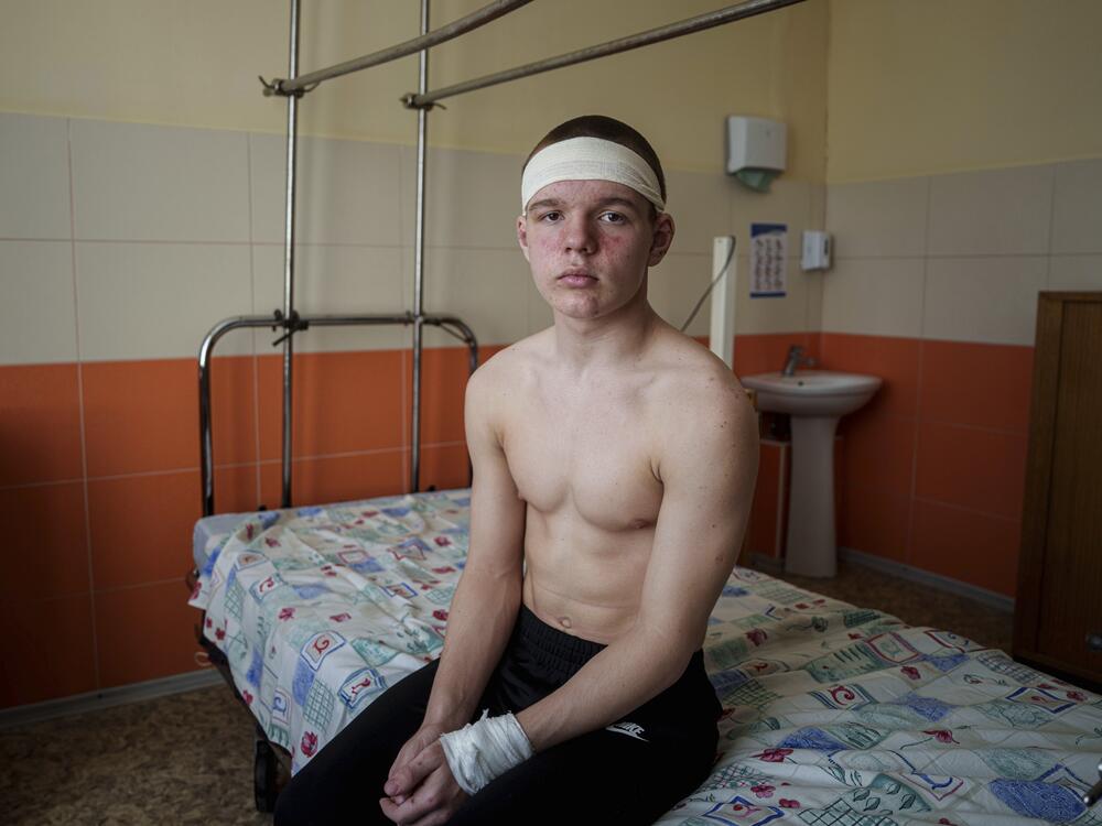 Kyrylo Illiashenko, 13, was injured after a Russian missile struck the center of Sumy, near the bus he and his mother were riding in April. He managed to rescue his mom and the other passengers. <br>