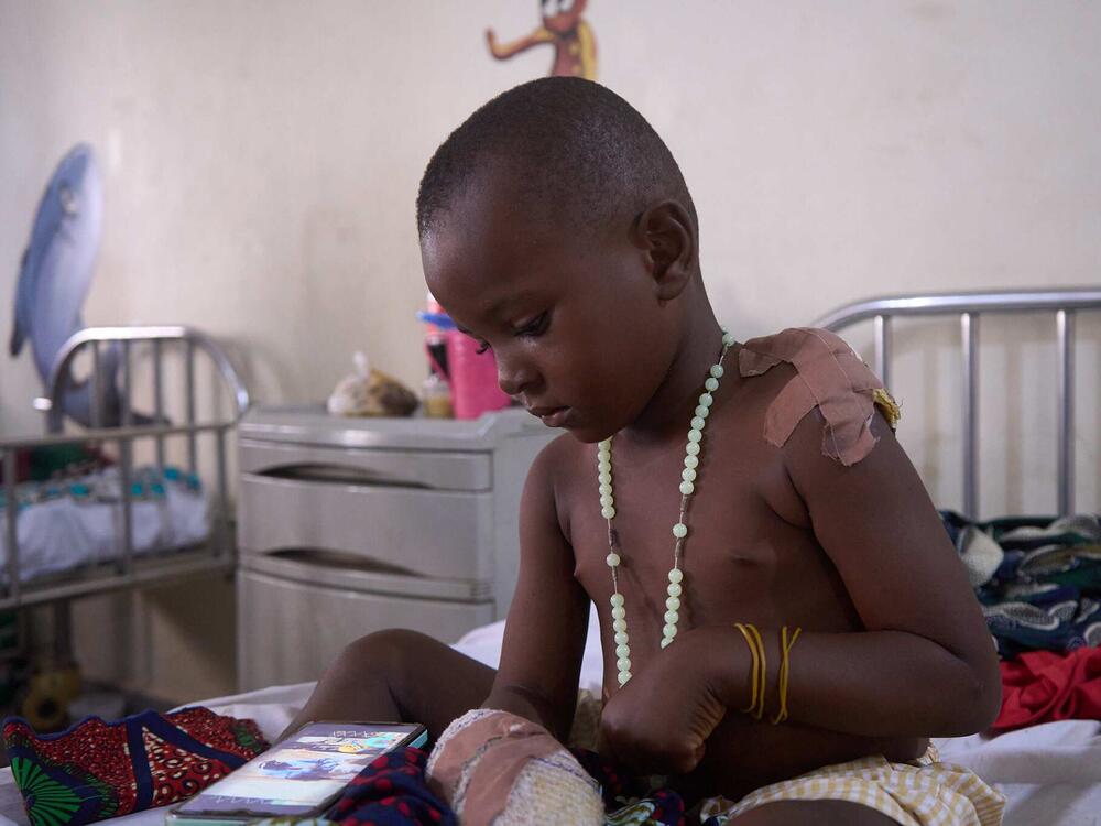 Four-year-old Onyuso David, who was hurt in the mid-June attacks, watches a comedy show on his grandmother's phone.