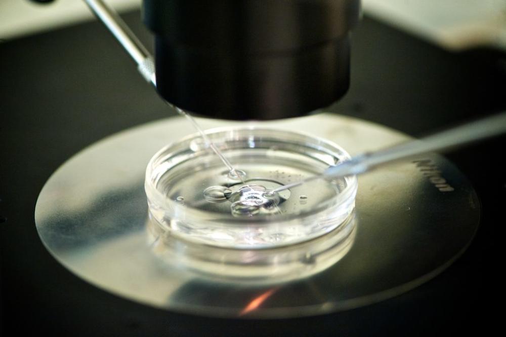 Ivf (Photo By BSIP/UIG Via Getty Images)