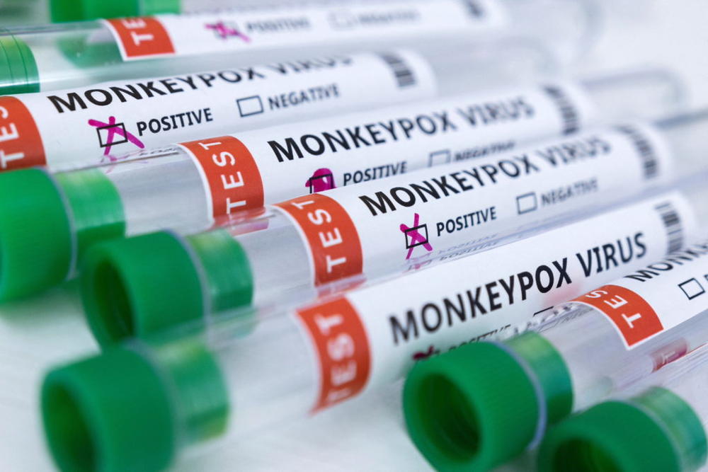 Test tubes labelled "Monkeypox virus positive and negative" are seen in this illustration taken May 23, 2022. REUTERS/Dado Ruvic/Illustration