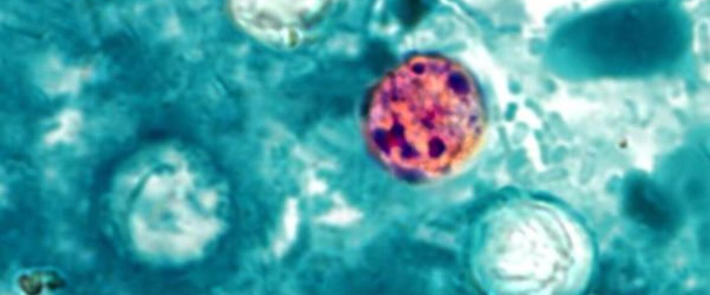 Courtesy, <a href="http://commons.wikimedia.org/wiki/File:Cyclospora_cayetanensis.jpg" target="_blank">Wikimedia</a>
