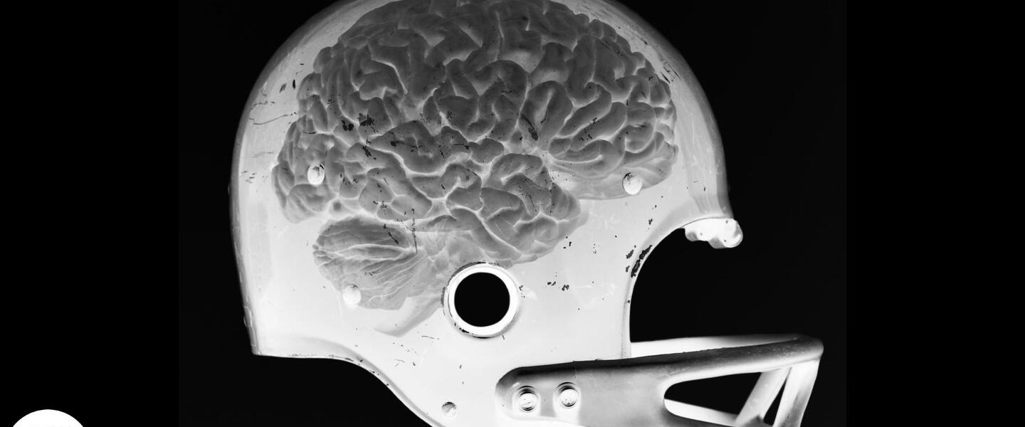 Are Concussions Deadly?: asset-mezzanine-16x9