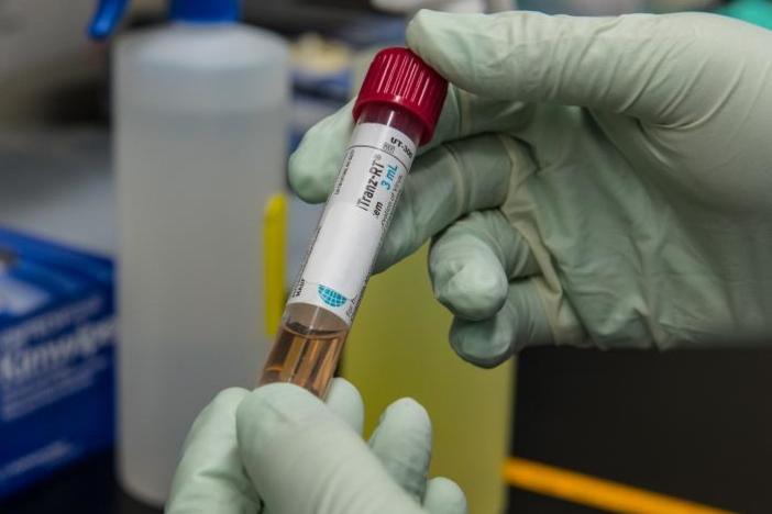 Patient's COVID-19 sample waiting to be tested