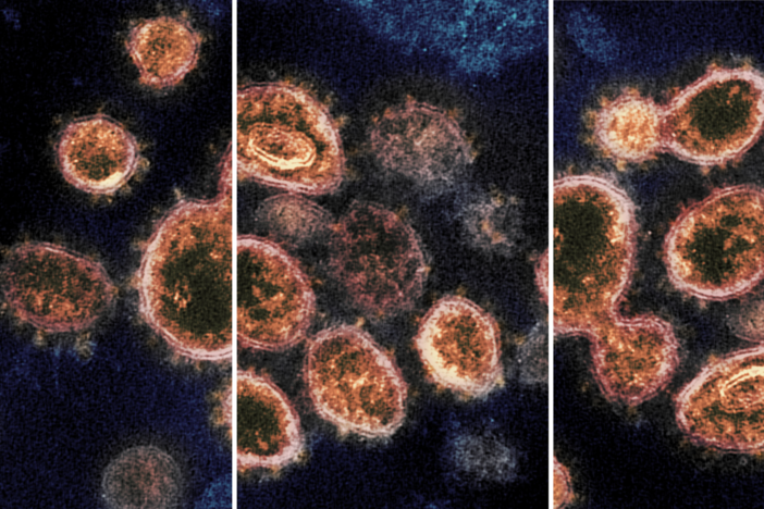 Images of the COVID-19 virus.